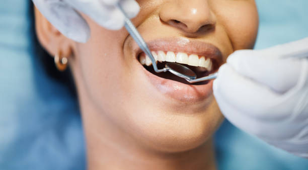 Best Emergency Wisdom Teeth Removal in St Augustine Beach, FL