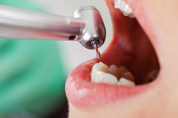 Best Emergency Dental Care for Trauma or Injury in St Augustine Beach, FL
